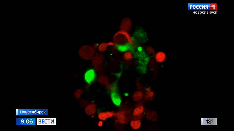 Ученые Новосибирска выращивают 3D-модели опухолей для испытаний лекарств от рака