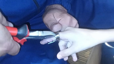 В Новосибирске спасатели вызволили ребенка из ловушки дверной ручки