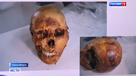 Новосибирские учёные раскрыли тайну древней хирургической операции